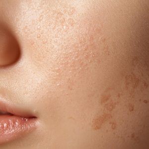 Scopri di più sull'articolo Abitudini quotidiane che rovinano la pelle