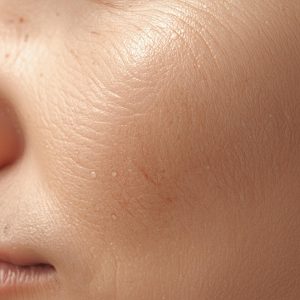 Scopri di più sull'articolo Pelle adulta reattiva? Forse è solo esasperata